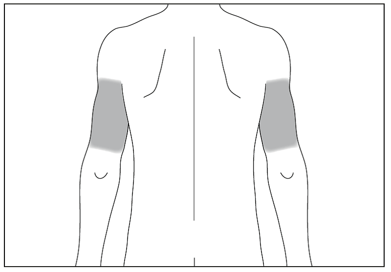 Bild 5. Om någon annan ger dig injektion, kan han eller hon även använda baksidan på dina armar.