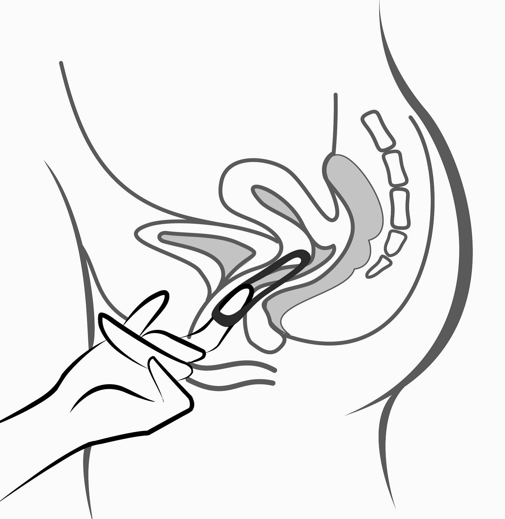 Bild 5: Ornibel kan tas ut genom att kroka fast pekfingret i nederkanten eller genom att fatta tag i kanten på ringen med pek- och långfingret och dra ut den