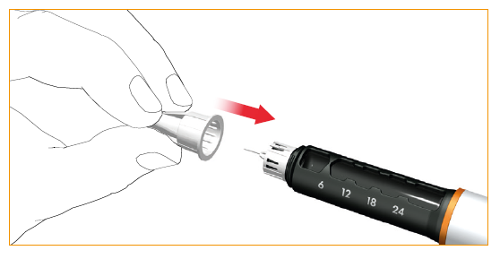 Avlägsnandet av nålen efter varje injektion  Nålen ska avlägsnas och kasseras efter varje injektion.  Placera försiktigt den yttre skyddshatten på nålen.