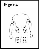 Figur 4 Figur 4