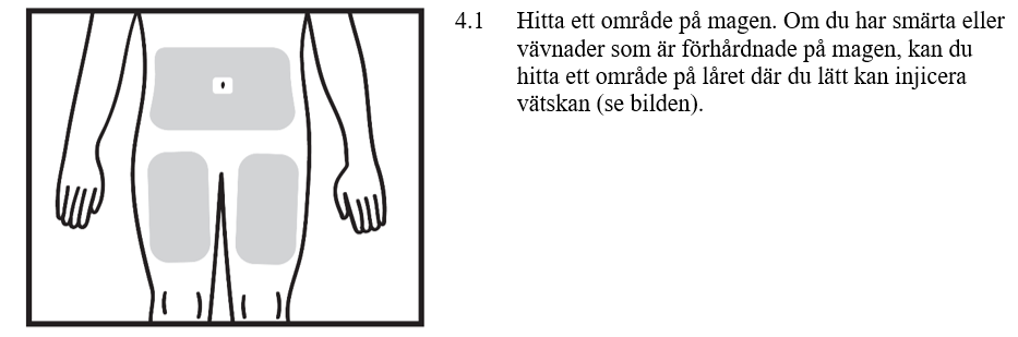 Figur 4.1