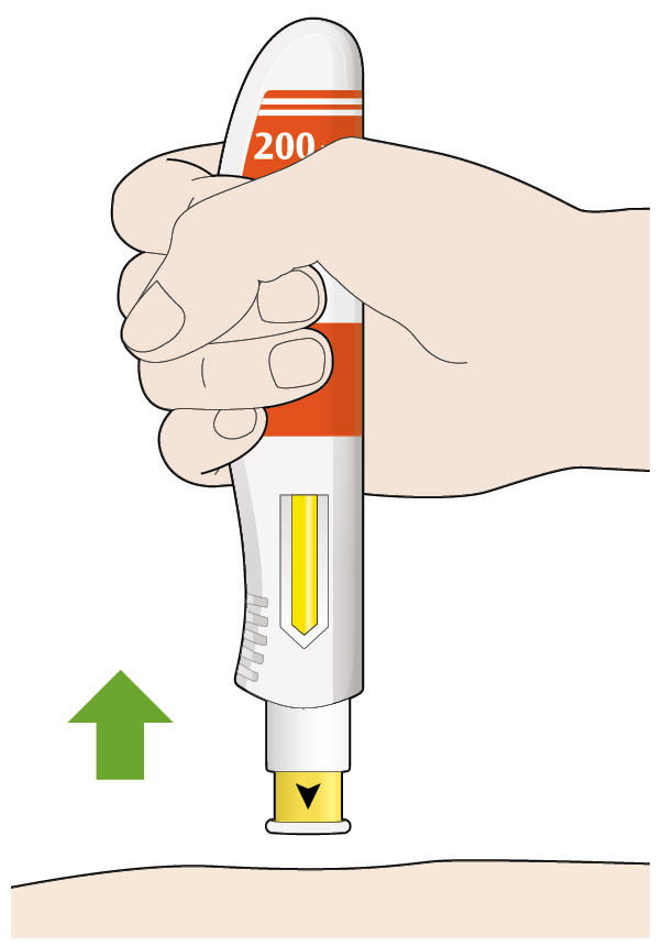 Bilden visar hur du drar ut pennan ur huden