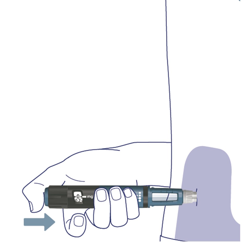För in injektionsnålen rakt in i magen (buken) eller låret i en 90 graders vinkel.