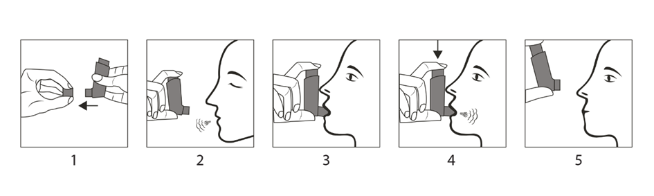 Steg 1-5