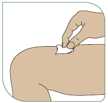 Använd en spritkompress till att tvätta huden på injektionsstället. Låt huden lufttorka. Kasta spritkompressen