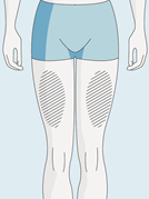 Övre delen av låren