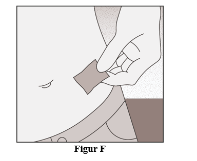 Figur F