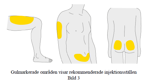 Gulmarkerade områden visar rekommenderade injektionsställen
