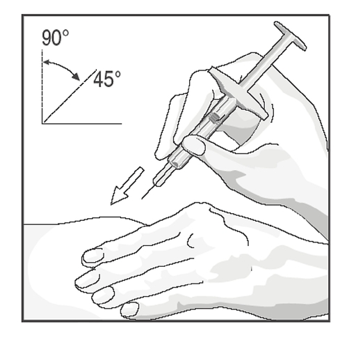 Bilden visar injektionsvinkel